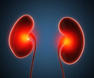 腎膿瘍の治療について知っておくべきこと