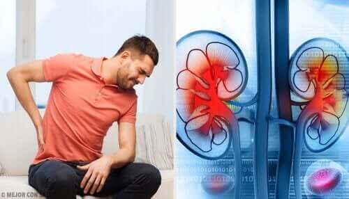 腎膿瘍は、膀胱で始まり、腎臓とその周辺に広がる尿路感染症によって起こります。今回の記事で詳しく学びましょう!このままご覧ください。 背中の痛みを感じている男性