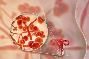 マイコプラズマ・ジェニタリウム:原因、症状、治療