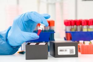 新型コロナウイルス検出：PCR検査って何？