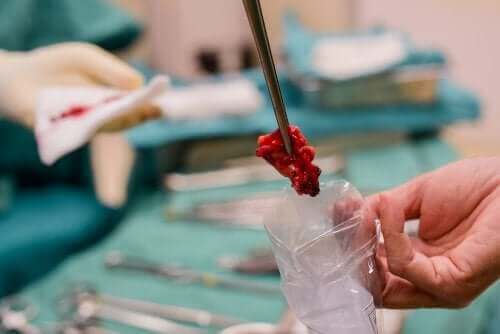 リキッドバイオプシー 組織生検の限界