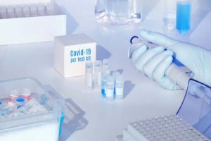 ウイルス量って何を表すの?