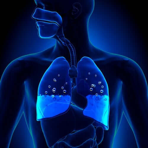 肺水腫：その原因と症状