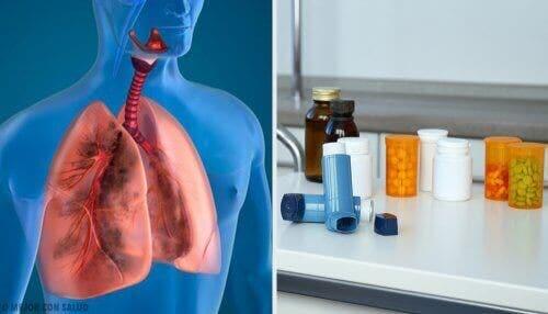 COPDの治療　エアロゾル療法って何？