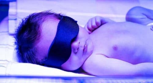 新生児黄疸について知っておくべきこと　新生児の光線療法
