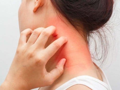 アトピー性皮膚炎について詳しく学ぼう！　皮膚を掻く女性