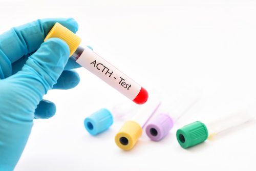 ACTH検査　コルチコトロピン ペプチドホルモン