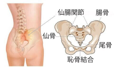 仙腸関節の過度可動性