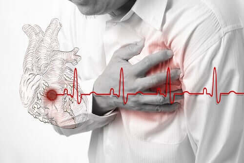 心臓発作　低用量アスピリン