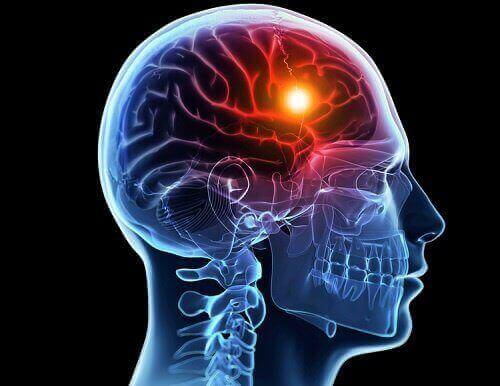脳低酸素症：種類と原因について　ライトアップされた脳