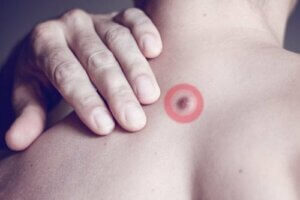 背中に脂肪の塊ができた! 原因は何?