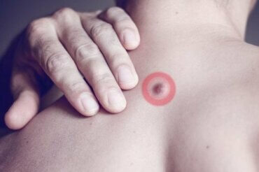 背中に脂肪の塊ができた 原因は何 みんな健康