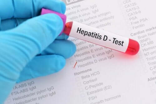 ５種類の肝炎とそれぞれの主な特徴について　肝炎の検査