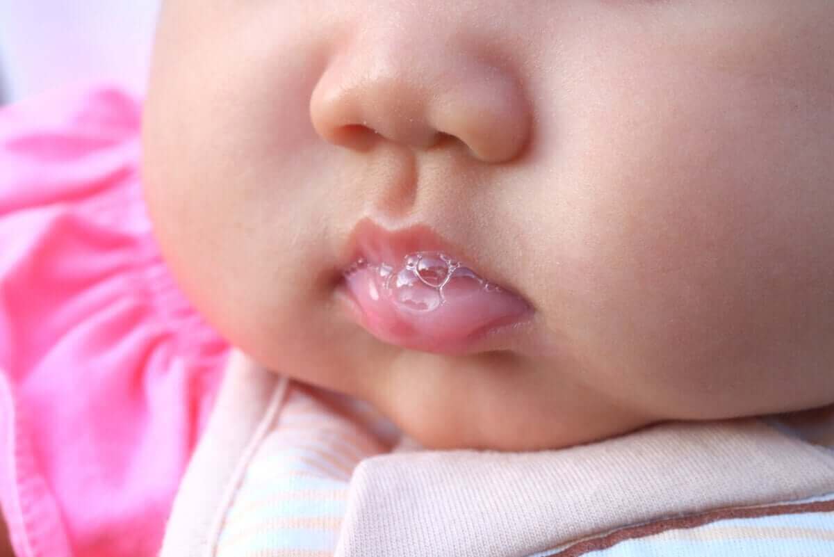唾液分泌過多症の特徴と治療法を学ぼう！　よだれを垂らす赤ちゃん
