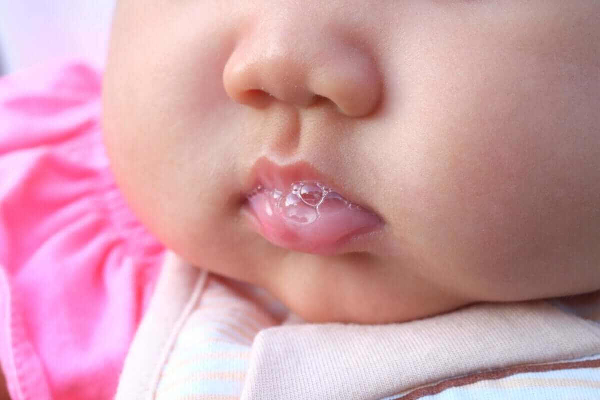 唾液分泌過多症の特徴と治療法を学ぼう! よだれを垂らす赤ちゃん