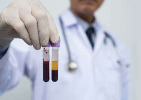 様々な治療に役立つ血漿輸血とは何ですか？　医師