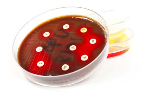 抗生物質感受性検査の用途