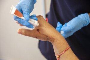 最も一般的なヒーリングクリームと軟膏について