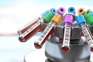 症状が出る前に腫瘍を発見する新しい血液検査
